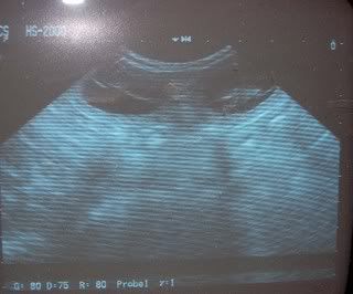 ultrasounjdpic.jpg