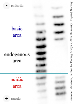 epo_doping_test_ief.png