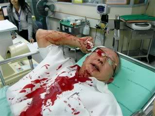Tis just a flesh wound