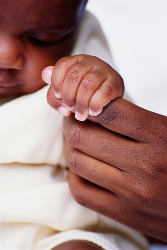 Mottling Skin In Babies